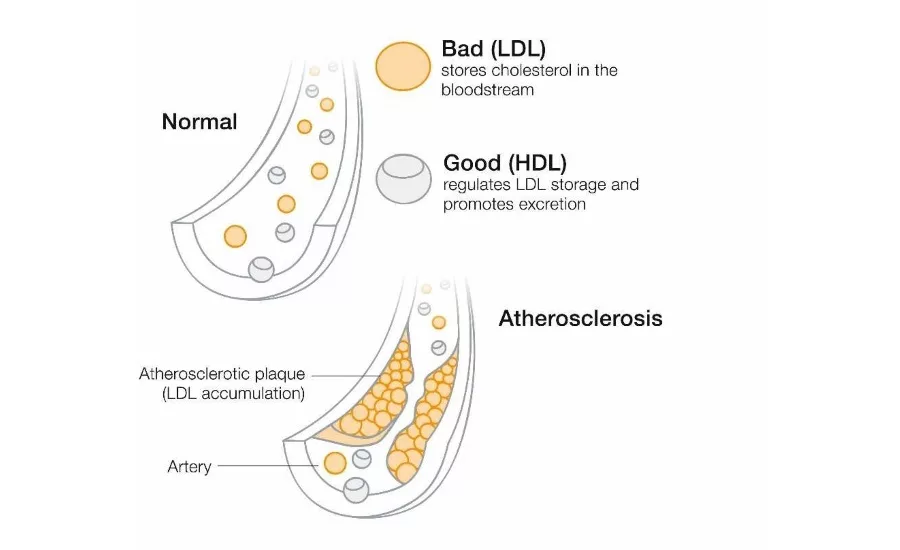 New study confirms that WACKERs Antioxidant HTEssence promotes heart health