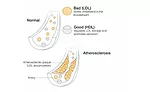 New study confirms that WACKERs Antioxidant HTEssence promotes heart health